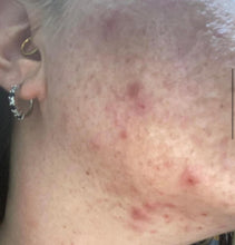 Load image into Gallery viewer, CLEAR SKIN KIT