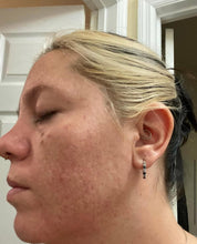 Load image into Gallery viewer, CLEAR SKIN KIT