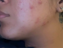 Load image into Gallery viewer, CLEAR SKIN KIT