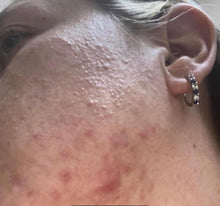 Load image into Gallery viewer, CLEAR SKIN KIT