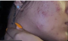 Load image into Gallery viewer, CLEAR SKIN KIT